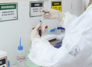 Laboratório Municipal de Palmas amplia a testagem com a chegada de mais 2.500 testes rápidos de Covid-19