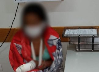 Adolescente de 15 anos defende mãe em discussão e acaba sofrendo cortes de foice