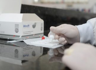 Palmas tem mais uma unidade sentinela para coleta de material biológico para exames da Covid-19