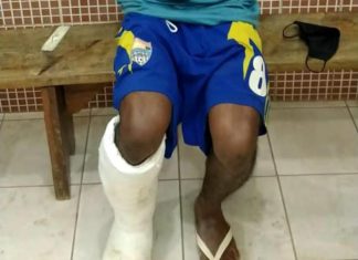 Com falsa fratura na perna, homem é flagrado tentando ingressar na CPP de Palmas com celulares escondidos em gesso