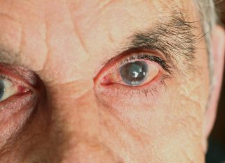 Tocantins catarata zero: Araguaína inicia agendamentos de cirurgias para mais 15 cidades