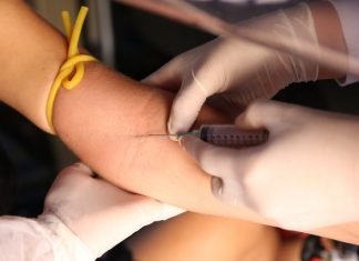 Pesquisa revela aumento na proporção de adultos com anticorpos para a Covid-19 em Palmas