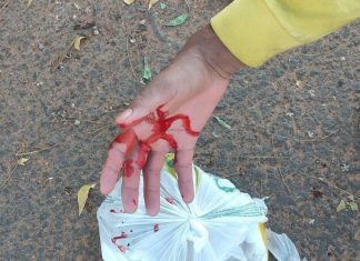 Trabalhador faz apelo na web após colega cortar mão em vidro durante coleta de lixo: ‘Luva não suportou’