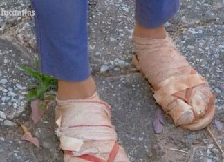 Mulher precisa enfaixar os pés ao andar 80 km para cumprir promessa ao Senhor do Bonfim