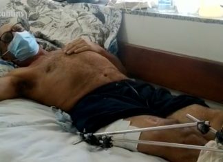 Filhos tentam conseguir R$ 50 mil para pagar cirurgia dos pais após acidente de trânsito