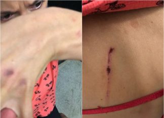 Advogada é suspeita de ter agredido servidora pública com deficiência em lava a jato