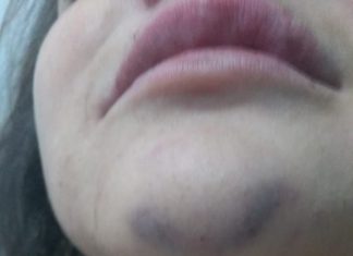 Mãe e filha são agredidas com socos na portaria de condomínio em Palmas; VÍDEO