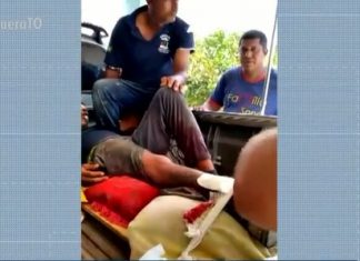 Jovem sofre fratura na perna e acaba sendo transportado na carroceria de caminhonete por falta de ambulância