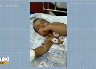 Bebê com cistos na cabeça está há um mês esperando cirurgia neurológica na rede pública