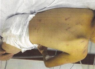 Polícia investiga se menino de oito anos que está intubado em hospital foi agredido pela mãe
