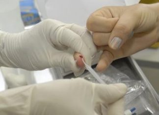 Mais de 250 pessoas são diagnosticadas com HIV este ano no Tocantins