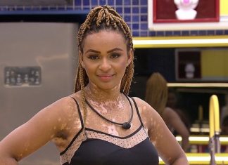 ‘BBB22’: pessoas com vitiligo dizem que presença de Natália ajudou a debater preconceito