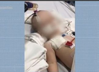 Mãe de bebê que passou por cirurgia no intestino diz que faltam remédios e dieta especial no HGP: ‘É um descaso’
