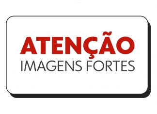 Homem tem ferimentos gravíssimos após cair de moto e ser lançado do veículo em Araguaína; Veja o vídeo