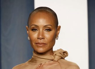 Alopecia: o que é a condição capilar que motivou agressão de Will Smith a Chris Rock no Oscar