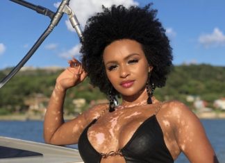 Equipe de Natália, do BBB22, denuncia ataques racistas e pelo vitiligo à polícia em BH