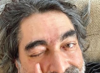 Zeca Camargo fala sobre estado de saúde depois cirurgia de emergência