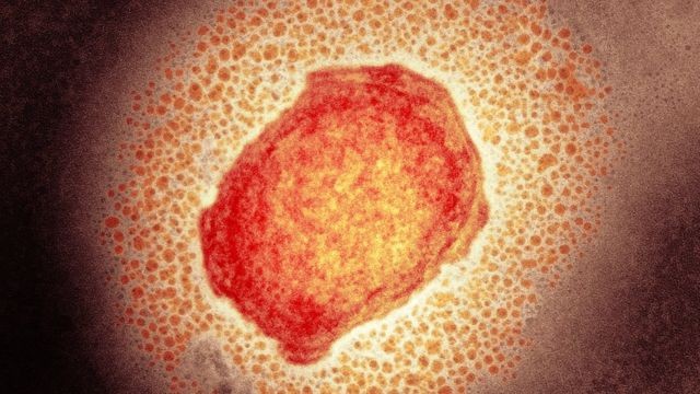 variola-dos-macacos-monkeypox