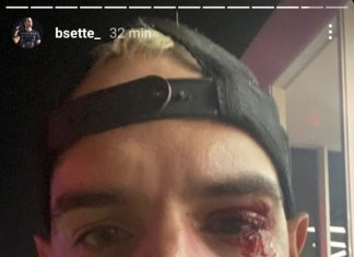 Fotógrafo é agredido depois de esbarrar em menina sentada em grama artificial do Rock in Rio
