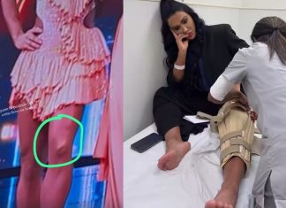 Gracyanne Barbosa fala sobre pausa após lesão no joelho: ‘Hoje começo a dança da recuperação’