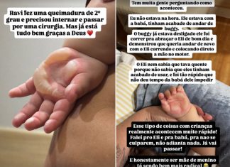 Filho de Viih Tube e Eliezer sofre queimadura na mão e passa por cirurgia