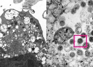 Reino Unido tem primeira morte por variante ômicron da Covid-19